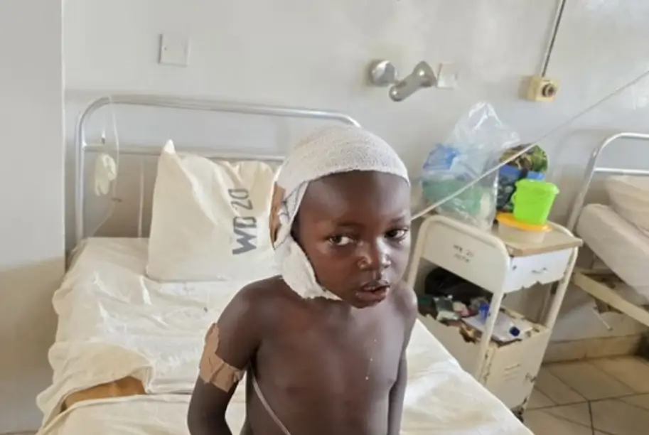 injured nigerian child
